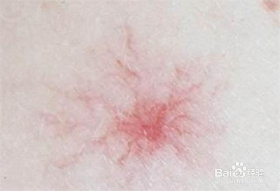 怎样判断自己的肝好不好?