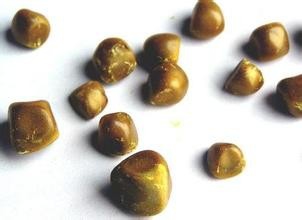 人体胆结石疾病如何分类