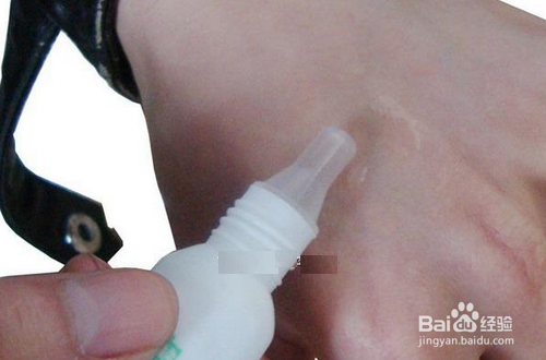 小孩伤口怎样预防疤痕?