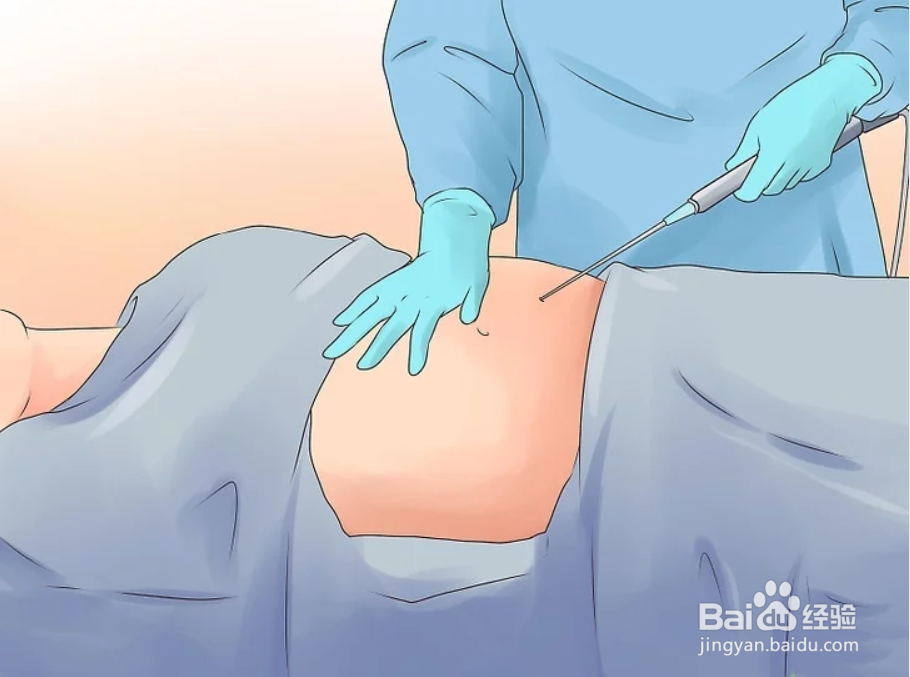 如何快速健康有效的减肥4种方法(图)