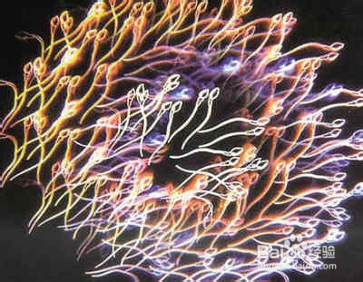 精子质量低还能治吗怎么提高精子质量