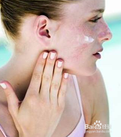 这8种肌肤问题概括了99%的人,你中了几枪?