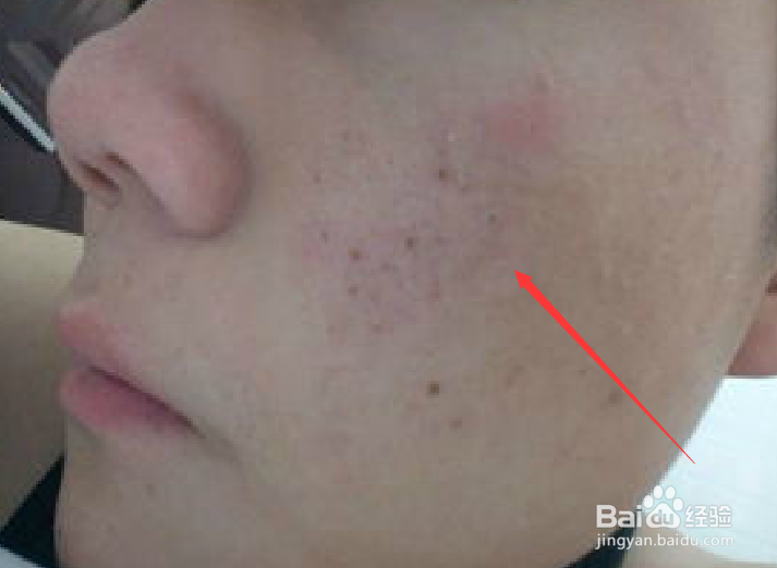 不同人群的便秘问题形成原因以及应该如何缓解