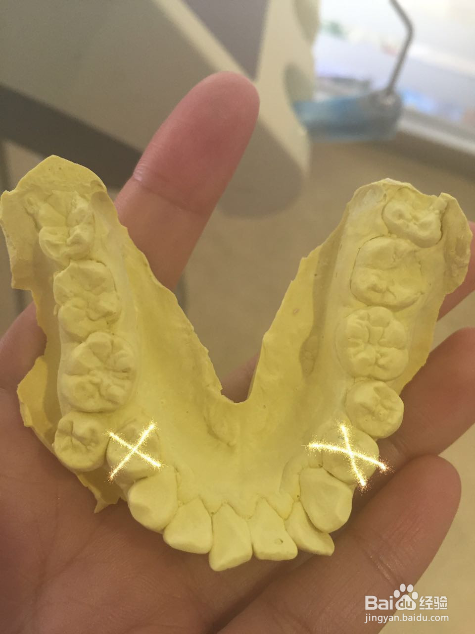 牙套妹经历的首次恐惧与痛苦