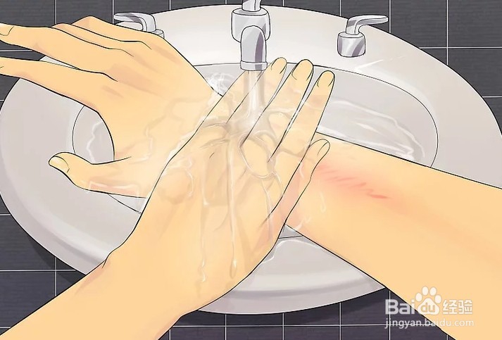 如何治疗皮肤过敏现象