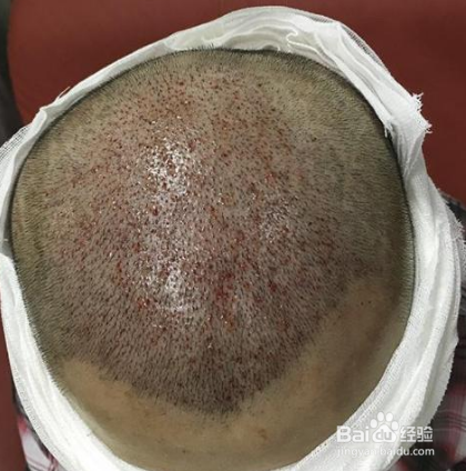 头皮有时候会疼是怎么回事