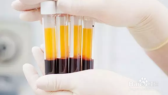 血液具有什么作用