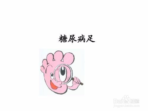 糖尿病足如何预防