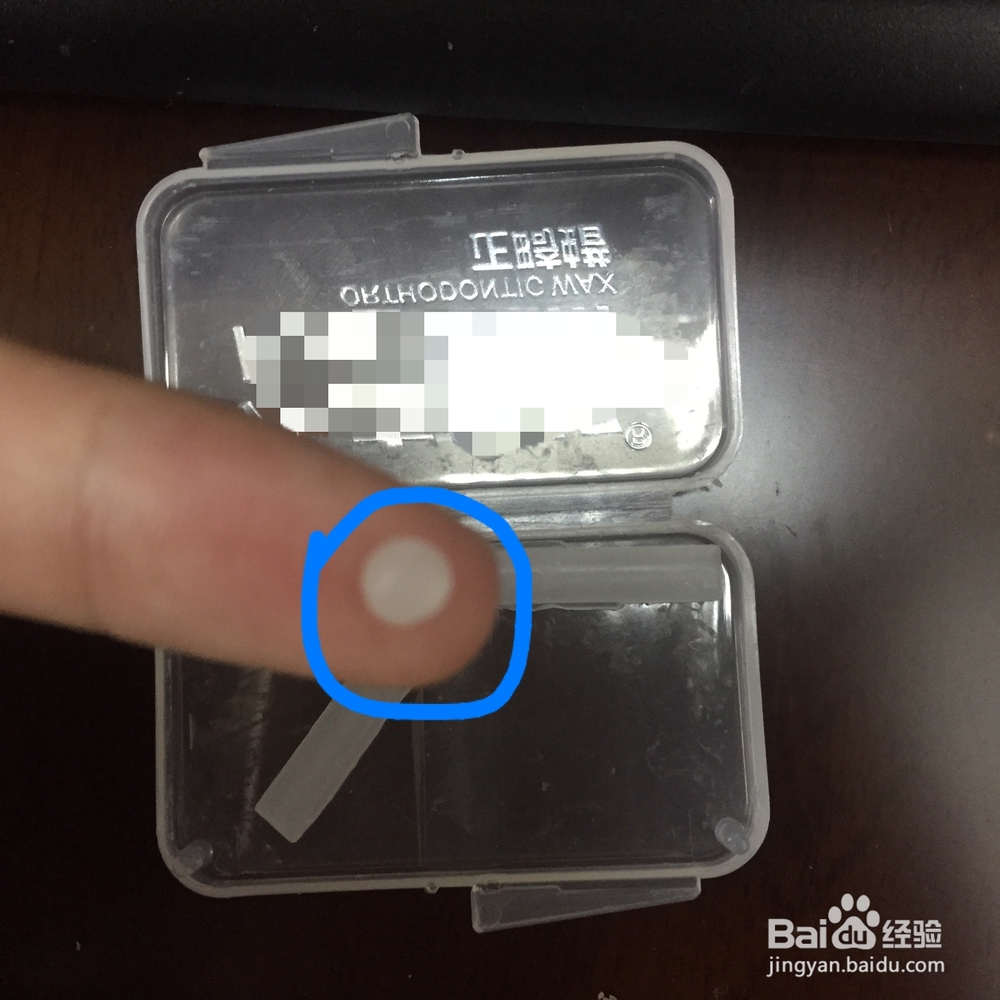 正畸蜡如何使用与保存