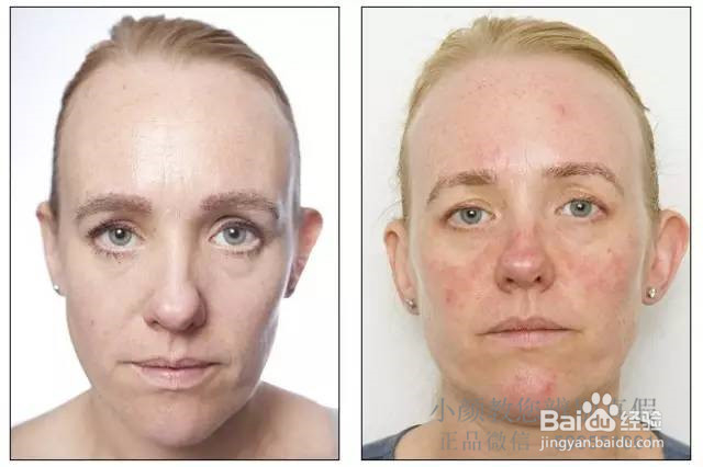 睡前要不要卸妆