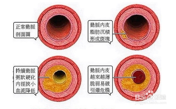 调脂药物有没有副作用?