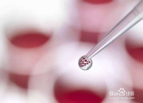 血友病有什么病症，会遗传吗？