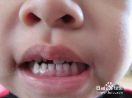 牙齿保健神话你能经常刷牙吗？