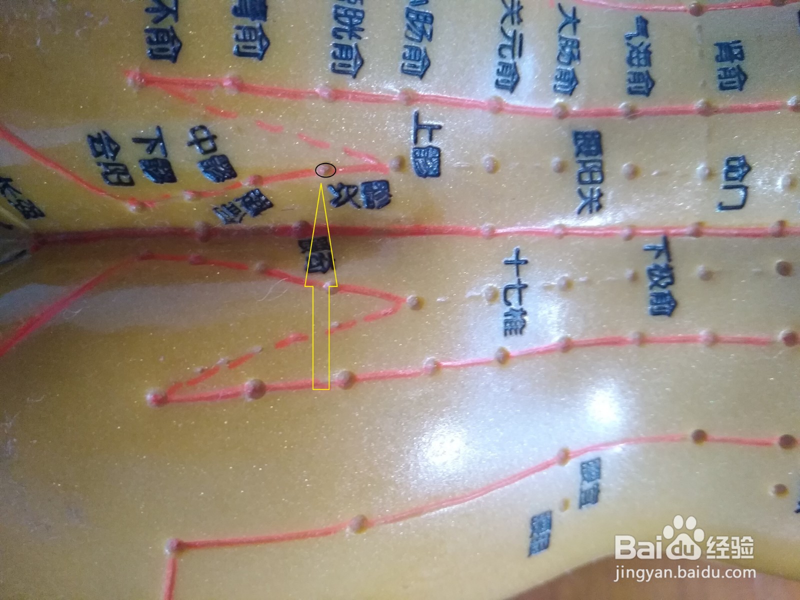 痛经怎么缓解