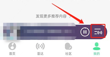 QQ音乐怎么关闭雷达模式