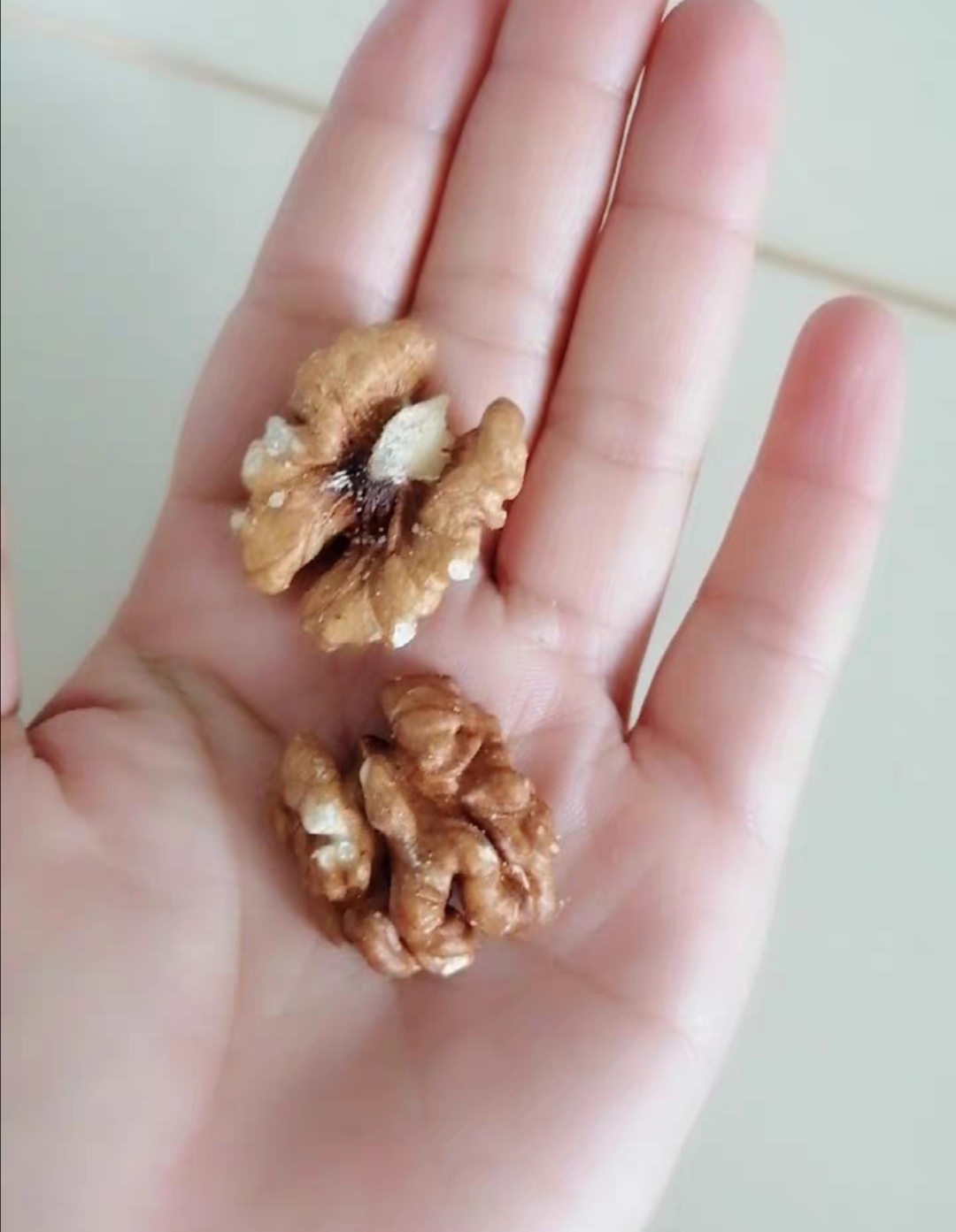 掉发严重怎么办这些食材帮你迅速恢复浓密发量