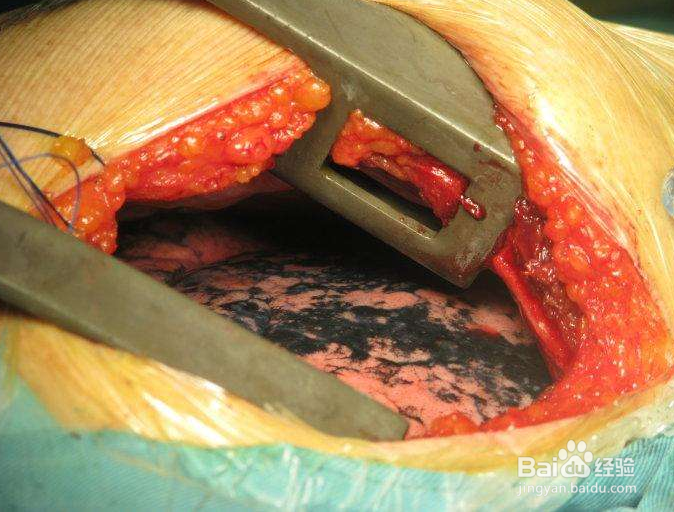 戒烟的好方法以及作用