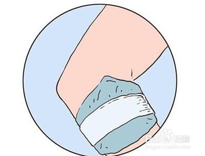 核桃树上虫子蛰了怎么办