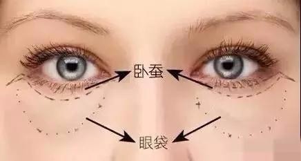 祛眼袋的方法