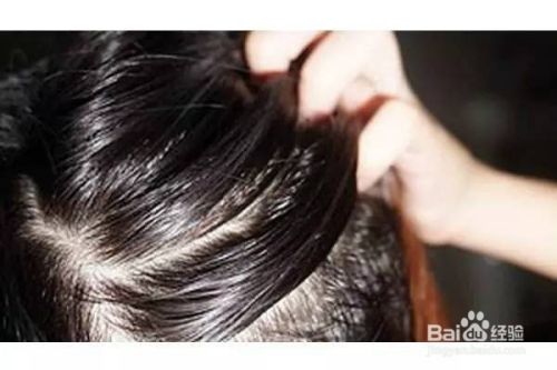 油发应该怎么办