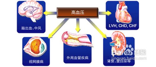 治疗高血压的无毒副降血压方法