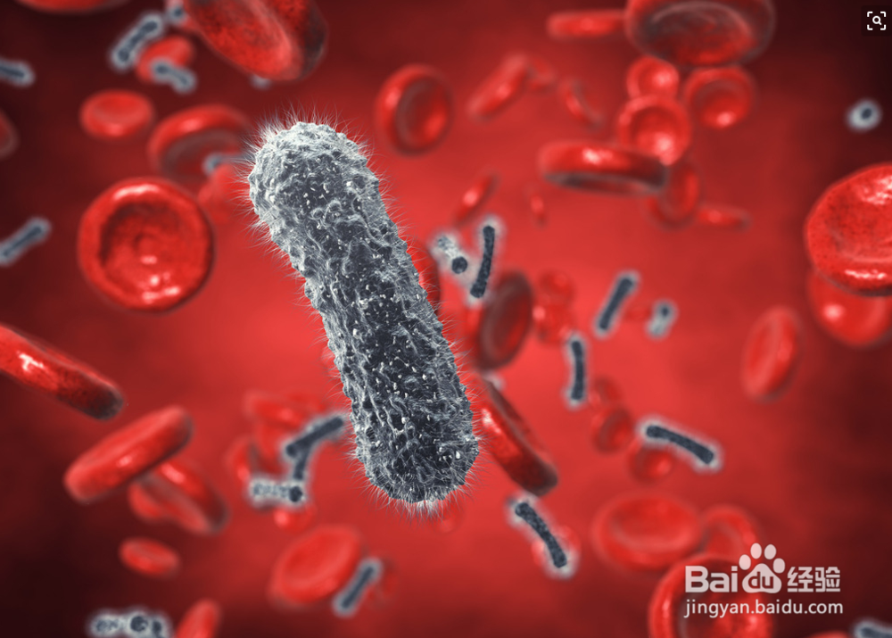 尖锐湿尤主要症状