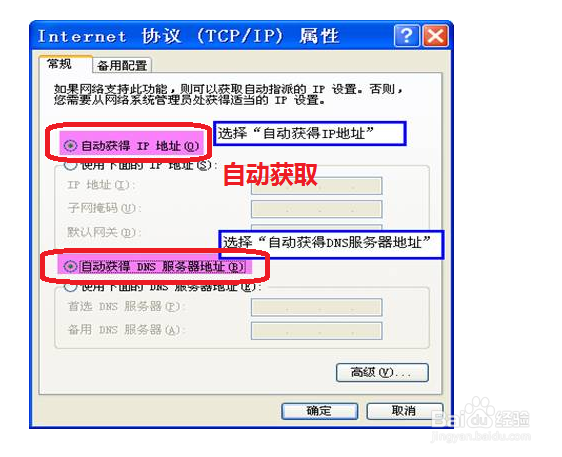 本地连接IP怎么设置好