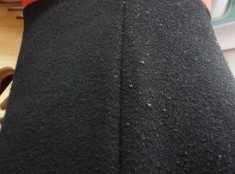 衣服上的纤维毛怎么去除