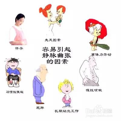 下肢静脉曲张的病因，如何康复治疗