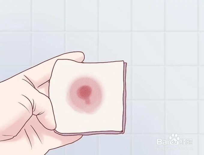 痔疮不想手术,有什么办法吗?