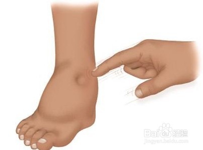 4个半月婴儿低蛋白血症怎么办