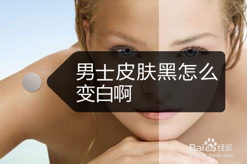 男士皮肤黑怎么变白