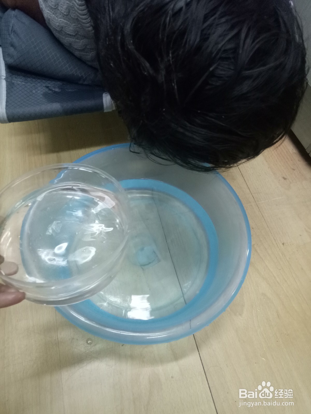 中耳炎患者手术后如何洗头发