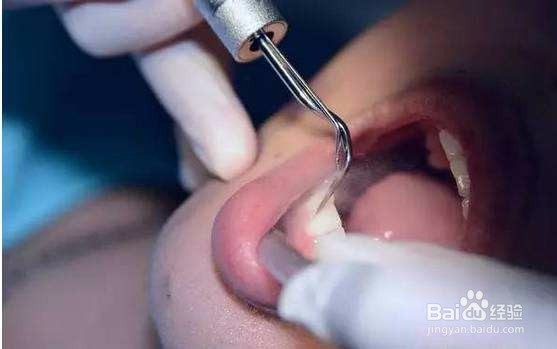 这些对待牙齿的习惯是错的你知道吗