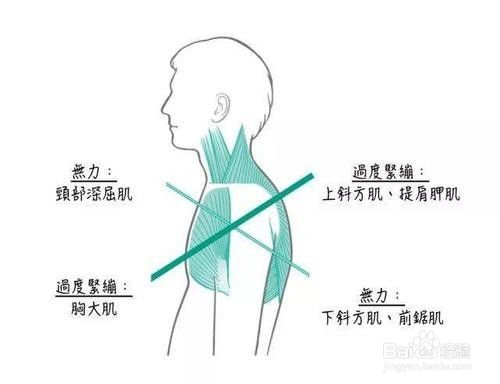 圆肩怎么矫正 百度经验