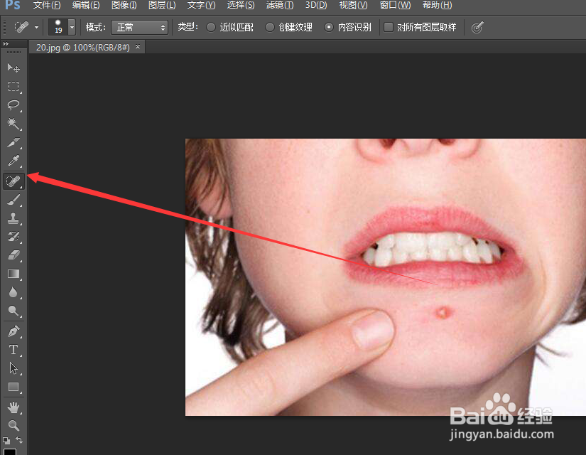 photoshop怎么给人物去除痘痘之污点修复工具