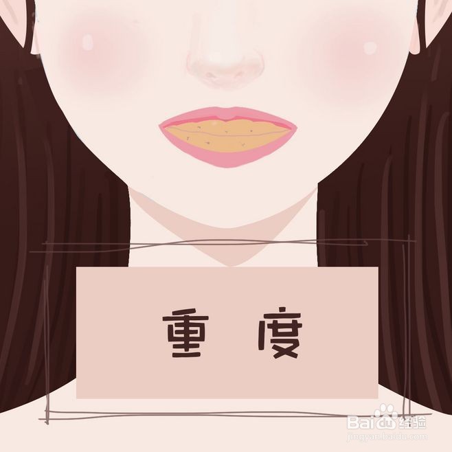 什么是氟牙症？有什么危害？