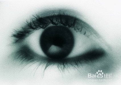 近视手术术后如何防止进水