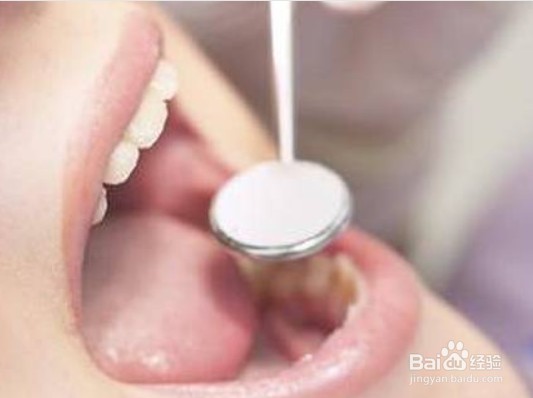 口腔溃疡膜的使用方法