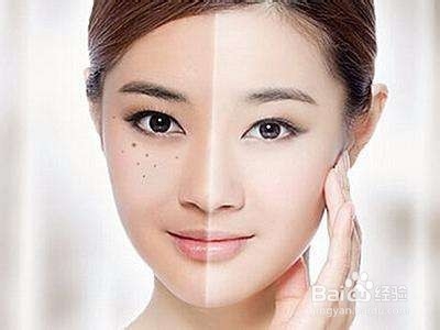 脸上长斑的祛斑方法