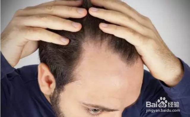 植发多少钱，植发后需要怎么保养