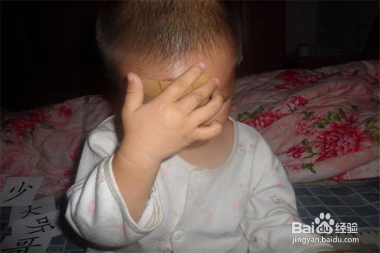 在幼儿园摔伤额头怎么赔偿