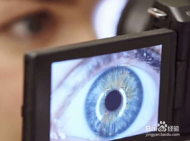 眼球萎缩佩戴义眼片