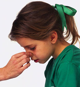 怎样处理流鼻血