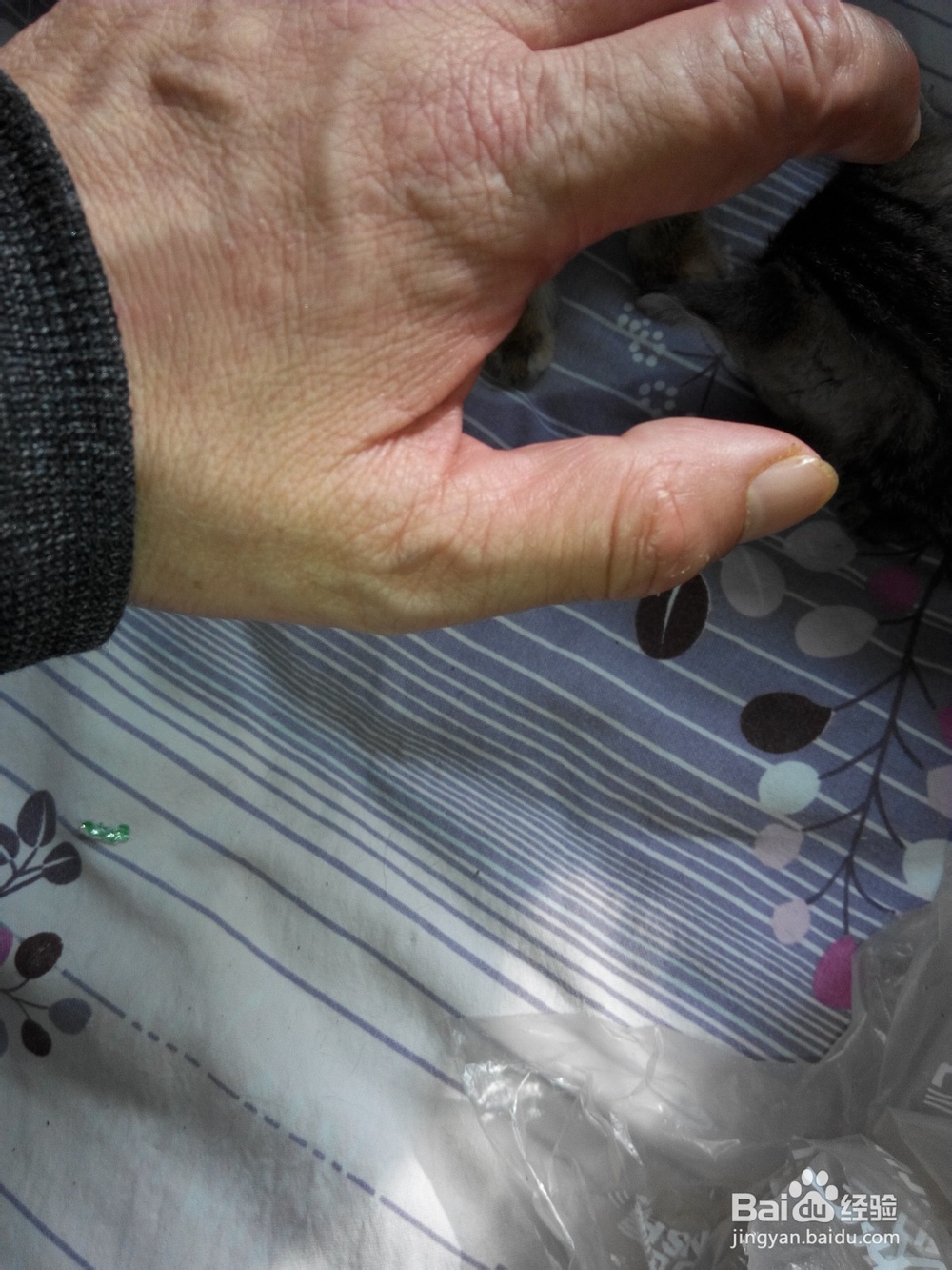 预防猫抓伤以及伤口处理