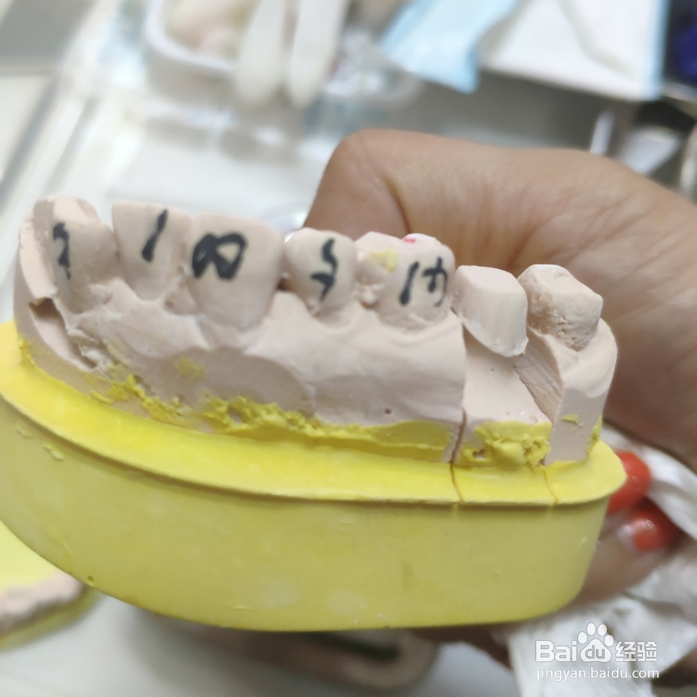 如何保护好我们的牙齿？