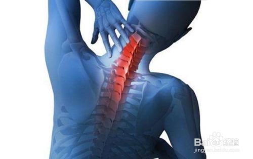 颈椎不好怎么办颈椎痛怎么办 百度经验 颈椎不好怎么办颈椎痛怎么办 百度经验