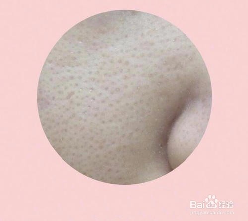 教你认识sk2清莹露的作用