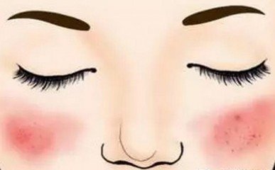 怎样才能让脸不红