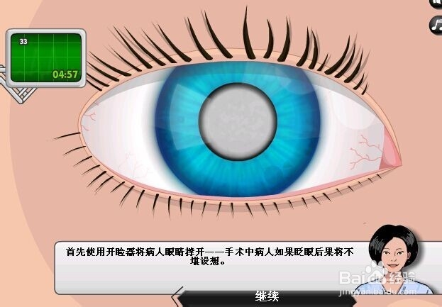 怎样在网上做眼科手术